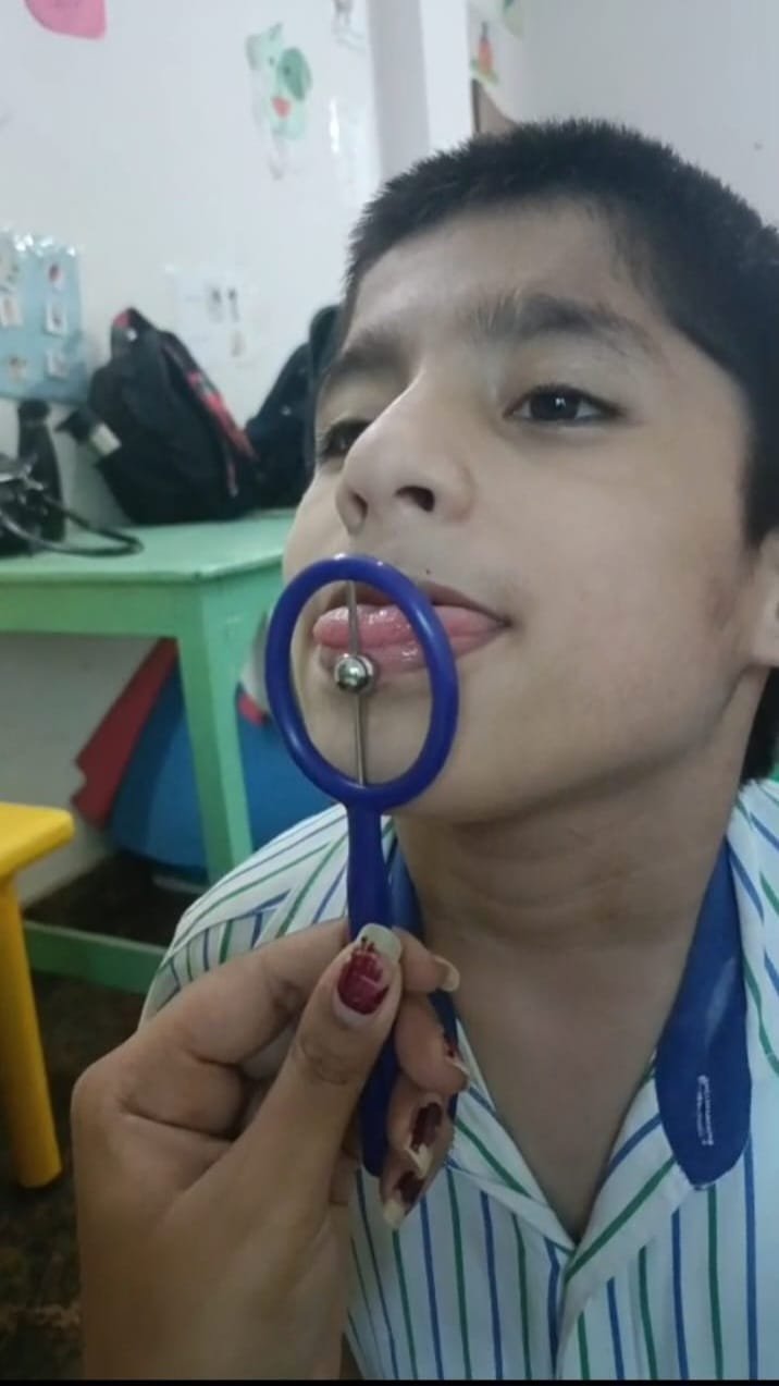 Speech & Language Therapy